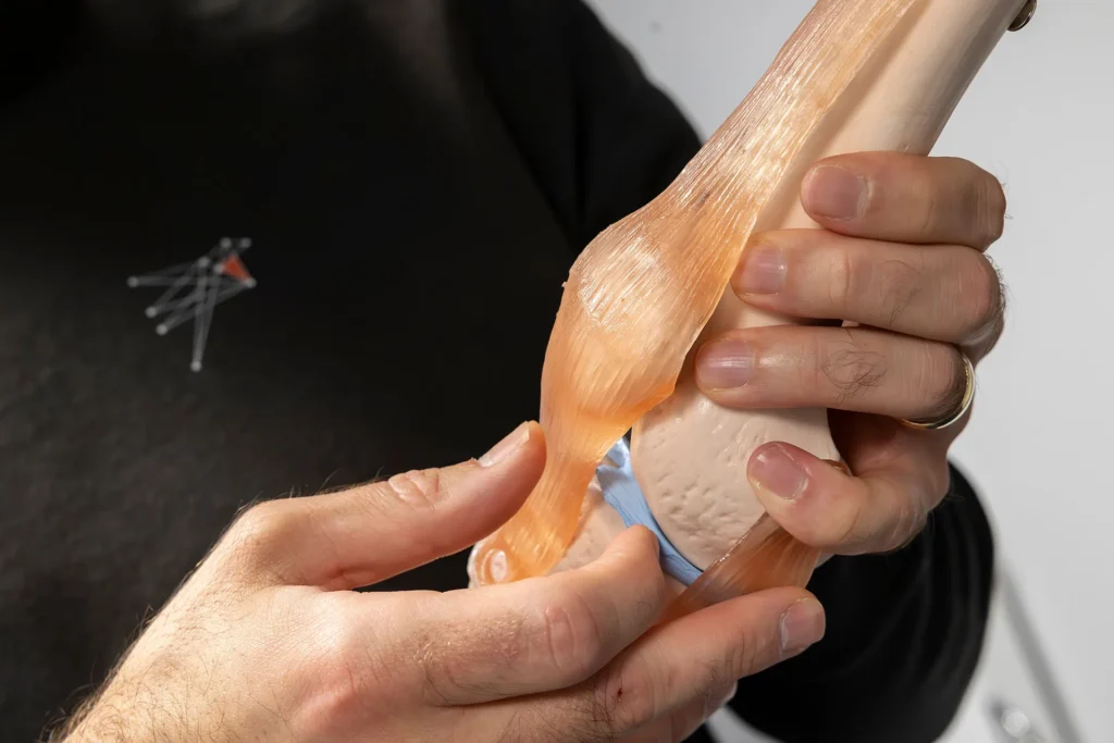 knee pain hamilton physiotherapy